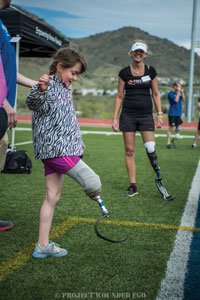 Mines Hosts Amputee Mobility Clinic